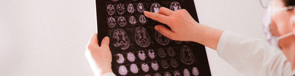 Curso de Psicologia: Dano Cerebral Adquirido