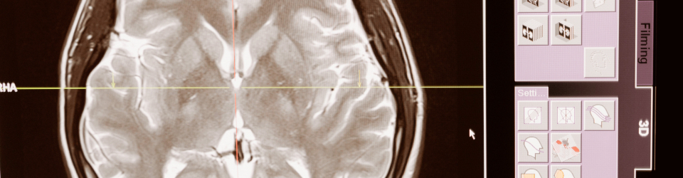 Tecnico en Neurologia (Curso de Neurologia Online Homologado con Titulacion Universitaria + 20 Creditos tradicionales LRU)