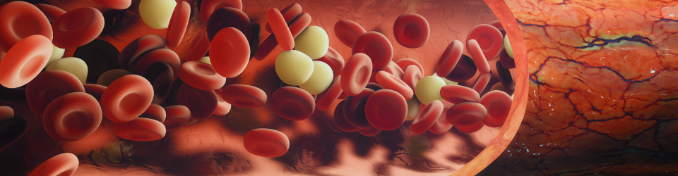 Experto en Enfermeria Cardiovascular