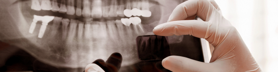 Experto en Radiologia Dental + Certificacion Universitaria en Radiologia (Doble Titulacion + 20 Creditos Tradicionales LRU)