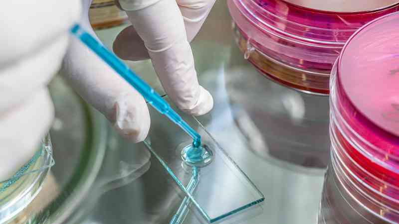 Master en Ensayos Microbiológicos