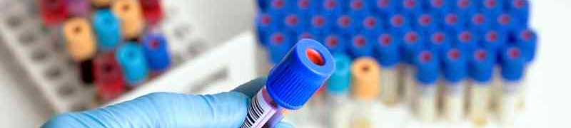 Operaciones de Pesada en la Elaboración de Productos Farmacéuticos y Afines