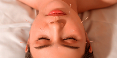 Curso de Acupuntura Estética Curso de Acupuntura Estética
