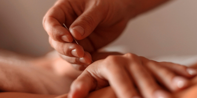 Postgrado en Acupuntura (TITULACIÓN PROFESIONAL de Acupuntor) Postgrado en Acupuntura (TITULACIÓN PROFESIONAL de Acupuntor)