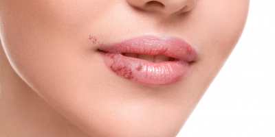 Especialista en Dermatología Pediátrica Especialista en Dermatología Pediátrica