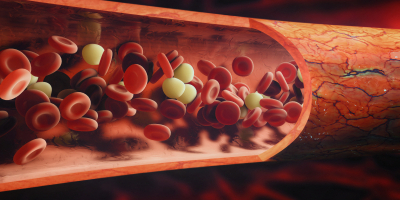 Especialista en Factores de Riesgo Cardiovascular en Ninos y Adolescentes Especialista en Factores de Riesgo Cardiovascular en Ninos y Adolescentes