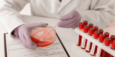 Tecnico en Hematologia y Hemoterapia Tecnico en Hematologia y Hemoterapia