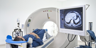 Especialista en Oncologia: Melanomas Especialista en Oncologia: Melanomas