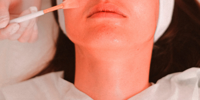 Especialista en Mesoterapia Facial Especialista en Mesoterapia Facial