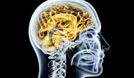Especialista en Neurorehabilitacion Especialista en Neurorehabilitacion