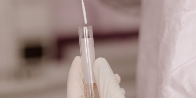 Curso Online de La Bioquímica de los Alimentos: Análisis Curso Online de La Bioquímica de los Alimentos: Análisis