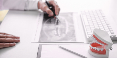 Curso Online de Operador Rayos X de Diagnostico Dental Curso Online de Operador Rayos X de Diagnostico Dental