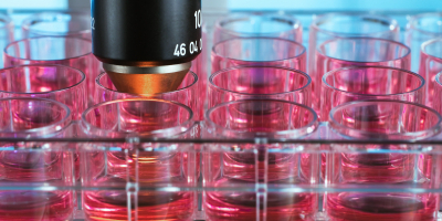 Especialista en Parasitologia Especialista en Parasitologia