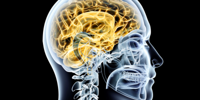 Postgrado en Patologias y Alteraciones Neurologicas Postgrado en Patologias y Alteraciones Neurologicas