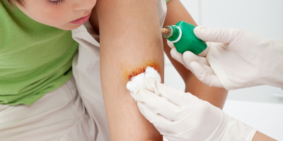 Curso Universitario de Patologías Más Frecuentes en Pediatría (Curso Homologado con Titulación Universitaria + 2 ECTS) Curso Universitario de Patologías Más Frecuentes en Pediatría (Curso Homologado con Titulación Universitaria + 2 ECTS)