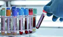 Tecnico en Analisis Clinicos: Especialidad Hematologia (Curso Homologado de ANALISTA CLINICO con Titulacion Universitaria + 20 Creditos tradicionales LRU) Tecnico en Analisis Clinicos: Especialidad Hematologia (Curso Homologado de ANALISTA CLINICO con Titulacion Universitaria + 20 Creditos tradicionales LRU)