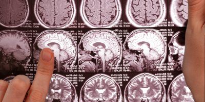 Especialista en Enfermedades Neurologicas Especialista en Enfermedades Neurologicas