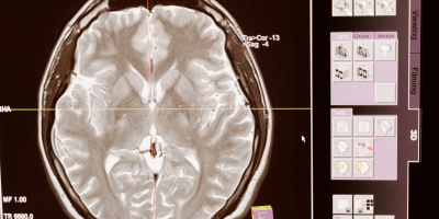 Especialista en Neurologia Especialista en Neurologia