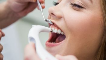 Experto en Cirugia Oral Experto en Cirugia Oral