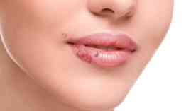 Master en Dermatologia, Cosmetica y Cuidado de la Piel + Titulacion Universitaria Master en Dermatologia, Cosmetica y Cuidado de la Piel + Titulacion Universitaria