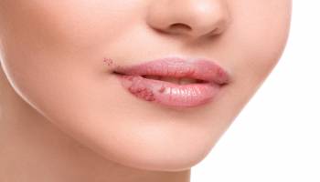Master en Dermatología Estética + Titulación Universitaria Master en Dermatología Estética + Titulación Universitaria