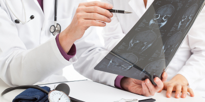 Master en Neuropsicologia Clinica Master en Neuropsicologia Clinica