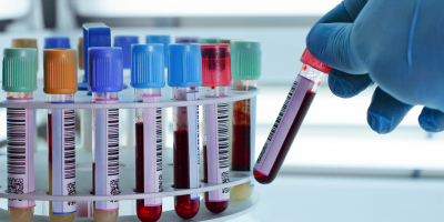 Curso Online Supervision y Control del Proceso Productivo de Fabricacion de Productos Farmaceuticos y Afines Curso Online Supervision y Control del Proceso Productivo de Fabricacion de Productos Farmaceuticos y Afines