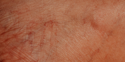 Curso en Fundamentos de Medicina Ortomolecular