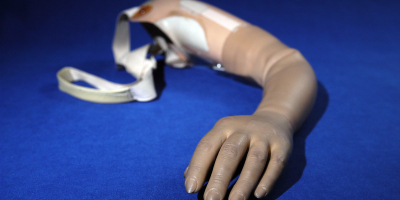 Experto Universitario en Ortopedia + 36 Créditos ECTS