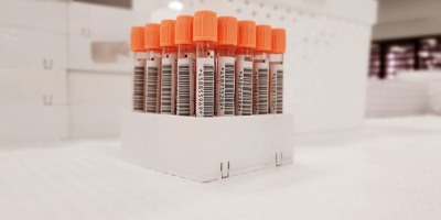 Master en Hematología, Banco de Sangre y Genética + Titulación Universitaria