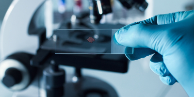 Master en Hematologia y Hemoterapia + Titulación Universitaria