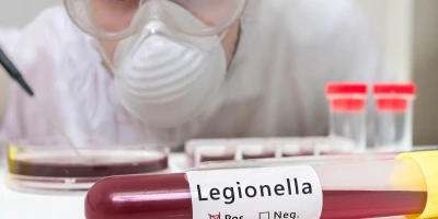 CURSO LEGISLACIÓN LEGIONELLA ONLINE: Curso en Legislación Sanitaria y Legionelosis 