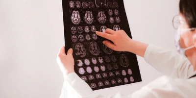 CURSO DAÑO CEREBRAL ADQUIRIDO: Curso de Psicología: Daño Cerebral Adquirido