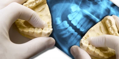 POSTGRADO ESTÉTICA DENTAL: Postgrado en Estética Dental
