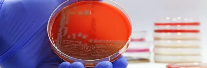 Estos son los ejemplos de bacterias gram positivas que no conoces