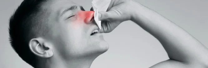 Todo lo que necesitas saber sobre la epistaxis