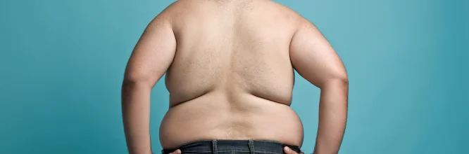 grados de obesidad