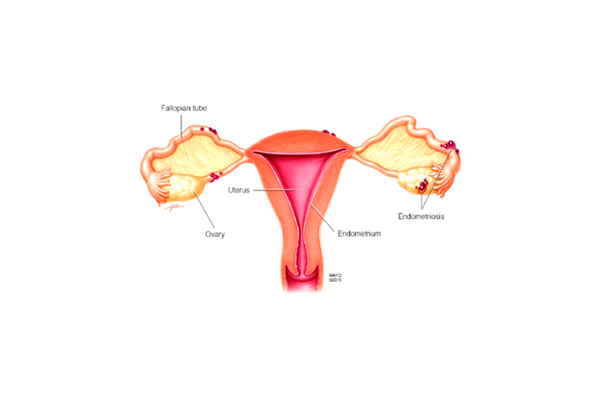 Sistema urinario femenino - Mayo Clinic