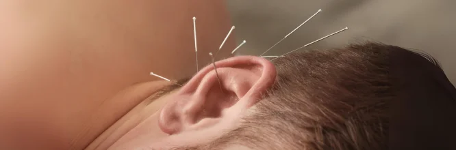 Descubriendo los puntos de acupuntura en la oreja