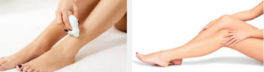 cursos de depilacion laser gratis online curso fotodepilacion